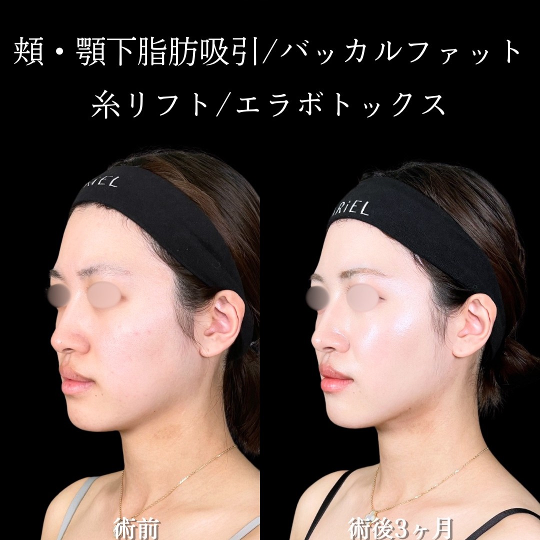 No.16487の症例写真2